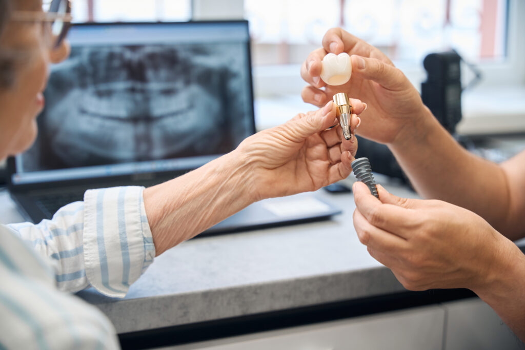 Implantes carga inmediata
