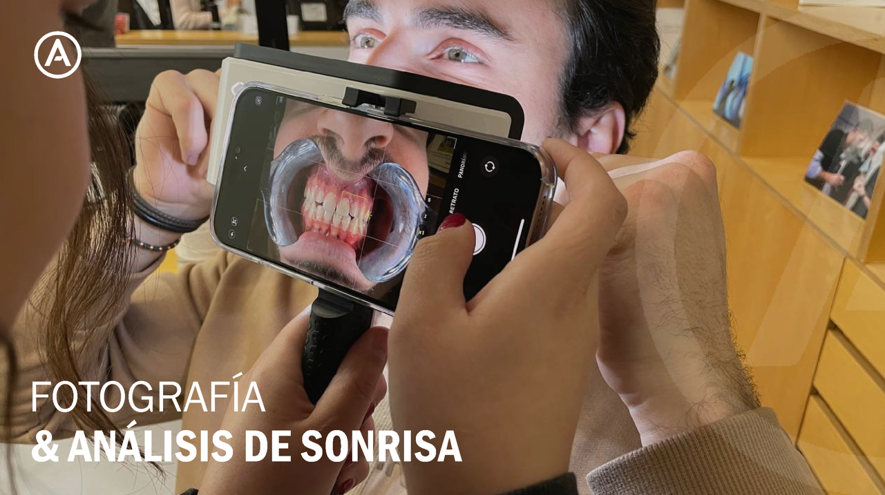 Fotografía y Análisis de Sonrisa