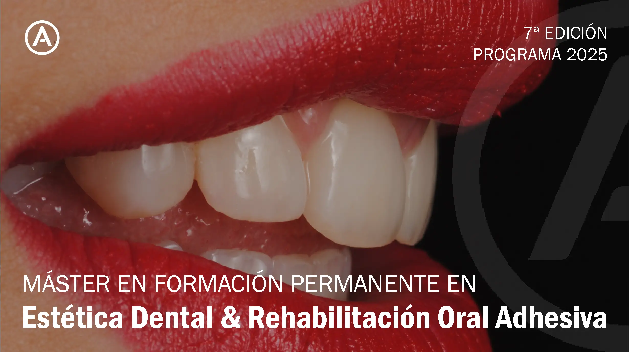 Máster en Formación Permanente en Estética Dental & Rehabiliación Oral Adhesiva 2025